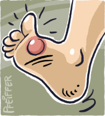 Huehnerauge